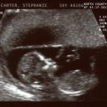 featured image Ocho Estados han Aprobado Leyes Contra el Aborto este Año