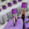featured image Lab-grown blood given to humans in world-first trial aimed at combatting rare disorders