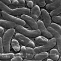 featured image “Se está expandiendo»: Las bacterias carnívoras proliferan en la costa este a medida que se calienta el clima, según un estudio