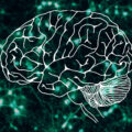 featured image $3M federal grant will allow study of protein causing Parkinson’s dementia